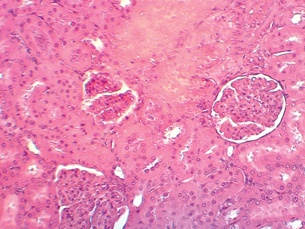 Kidney glomerulus at 150X